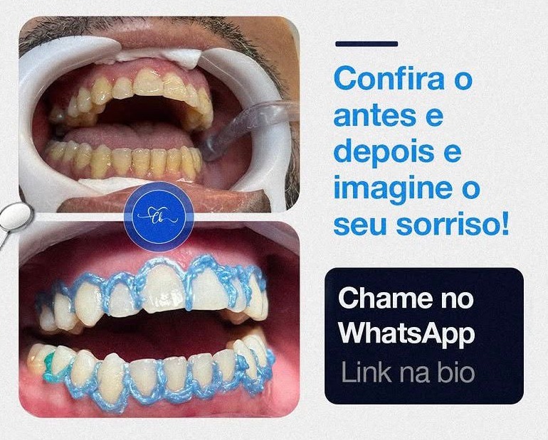 Antes e depois de um tratamento realizado pela Dra. Cristina Braz